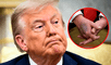 Donald Trump revela moretón en su mano durante un evento en la Sala Oval.
