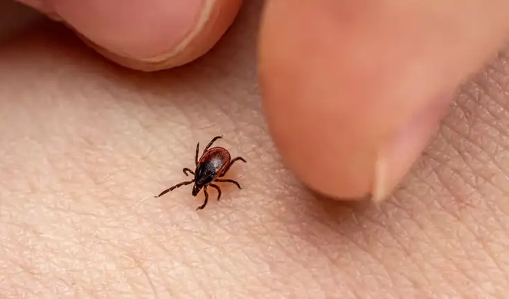 El piloto falleció por el síndrome de alfa-gal, una alergia a las carnes rojas con picaduras de garrapata. El piloto falleció por el síndrome de alfa-gal, una alergia a las carnes rojas con picaduras de garrapata.